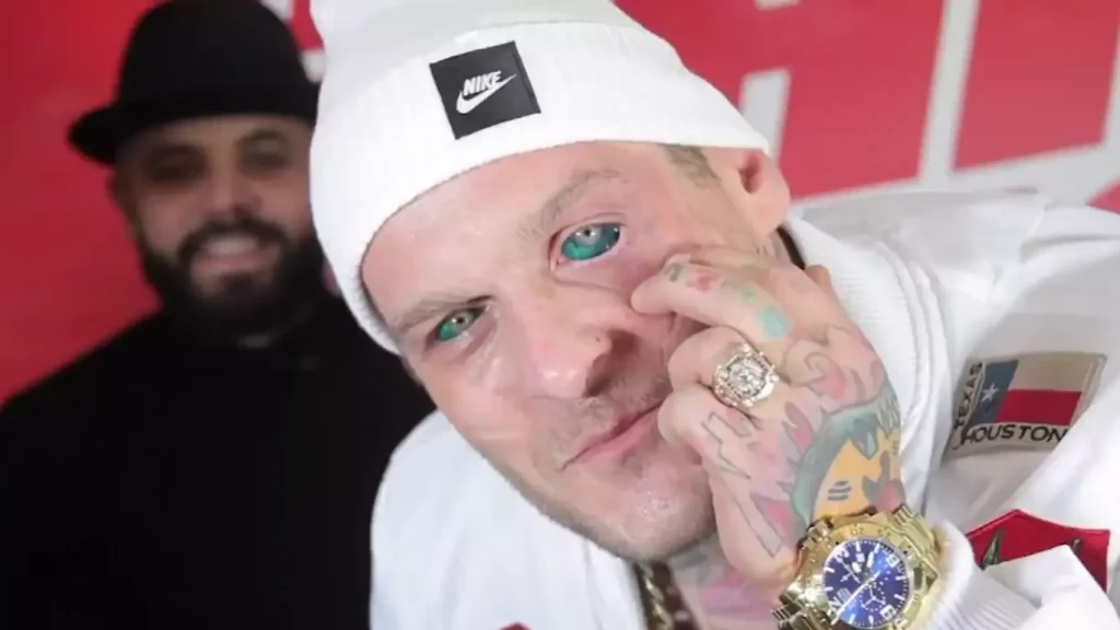 Mexican Man’s Green Eyeball Tattoo Gone Wrong